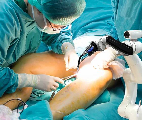Best lower limb reconstruction surgeon in India